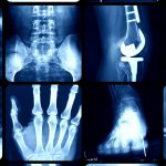 Orthopedic Clinic